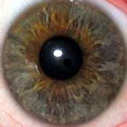 Cuba did 557 cornea transplants in 2007